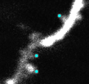 神経細胞のSpine先端検出アルゴリズムの開発